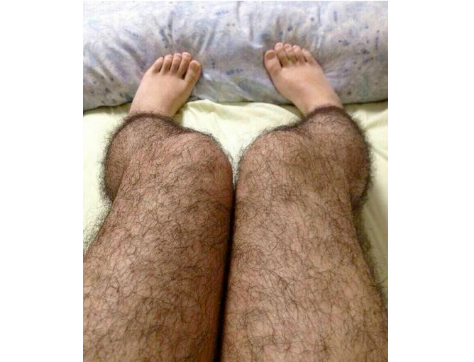 Hairy Leg Pictures 81