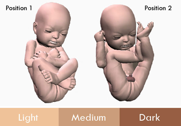 3D Printed Replica Of Your Unborn Fetus