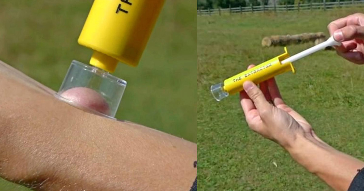 Bán Buôn Ngoài Trời Khẩn Cấp Venom Extractor Bơm Chân Không Rắn Bite Kit Surviva