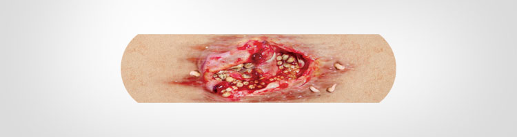 Boo-Boos Band-Aids Pictures of Severe Injuries
