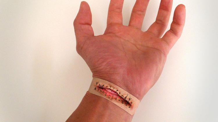 Boo-Boos Band-Aids Pictures of Severe Injuries