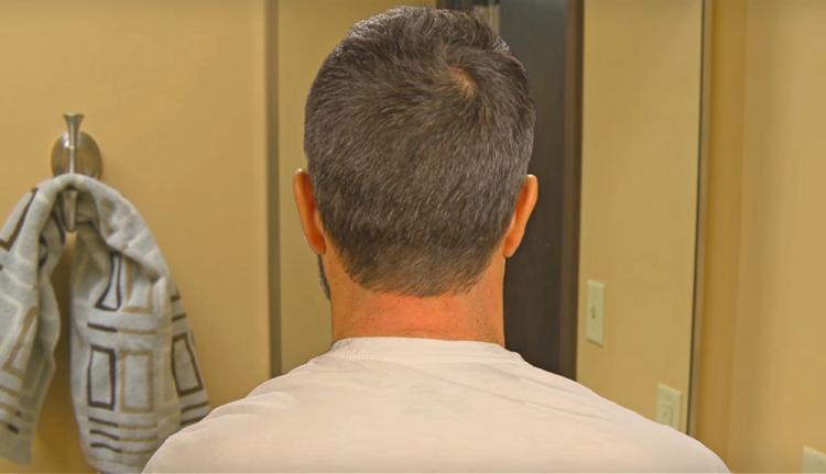 back of neck hair trimmer