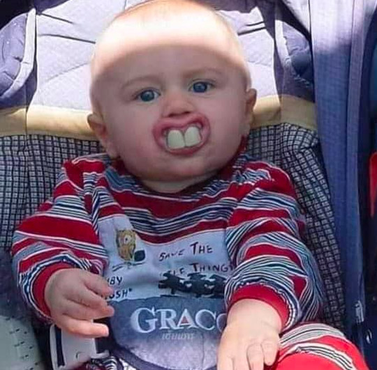 funny teeth pictures