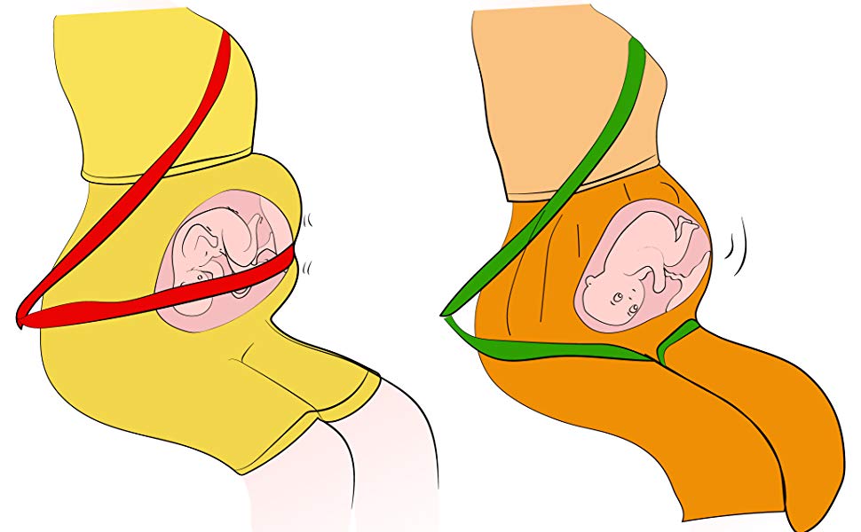 Cinto de segurança para gravidez - Cinto de segurança protege o feto em acidente de carro