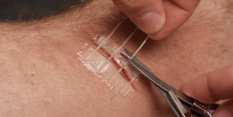 ZipStitch Home Laceration Kit Lets you heal wounds without stitches - DIY Home stitches