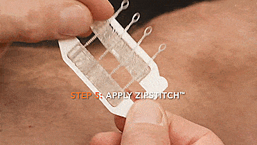 ZipStitch Home Laceration Kit Lets you heal wounds without stitches - DIY Home stitches