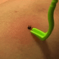 Tick Twister Tick Remover