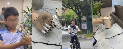 Child using a mini BrainCo Intelligent Bionic Hand