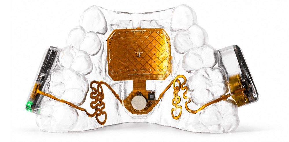 Augmental MouthPad clear dental-retainer touchpad with gold circuitry